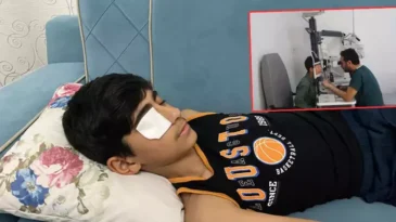 Yapıştırıcı Sıçrayınca Kapanan Göz Kapağı Doktor Müdahalesiyle Açıldı