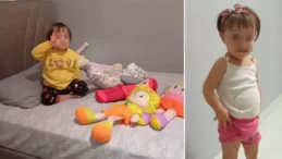 Down Sendromu Davasında Arabuluculukta 700 Bin TL Reddedildi, Mahkemeden 77 Milyon TL Tazminat Kararı